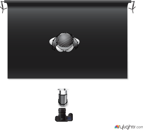 Frontal superior dura by Guest User